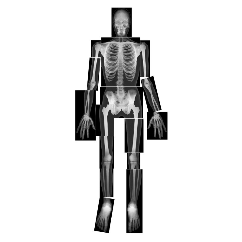 Roylco® True to Life Human X-Ray Set, Pack of 18