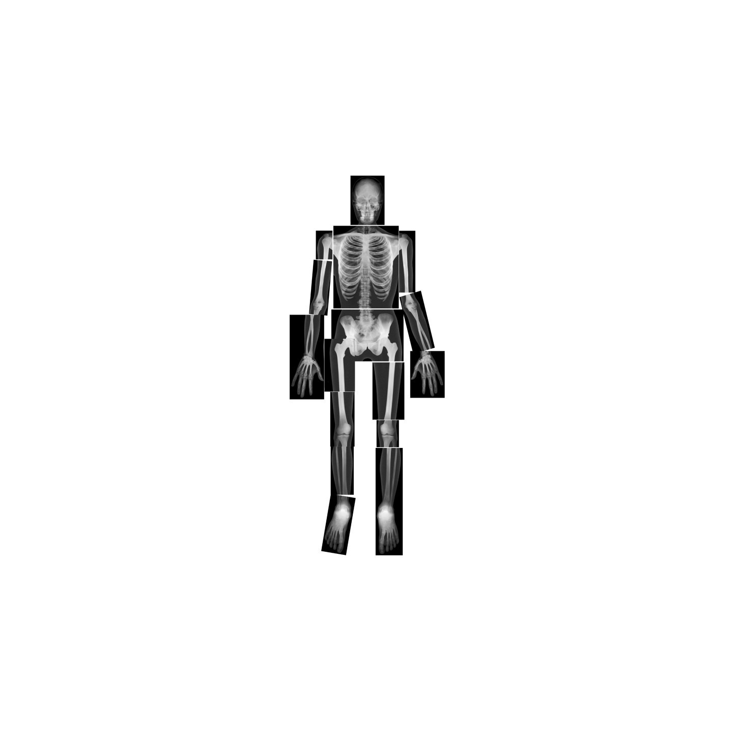 Roylco® True to Life Human X-Ray Set, Pack of 18