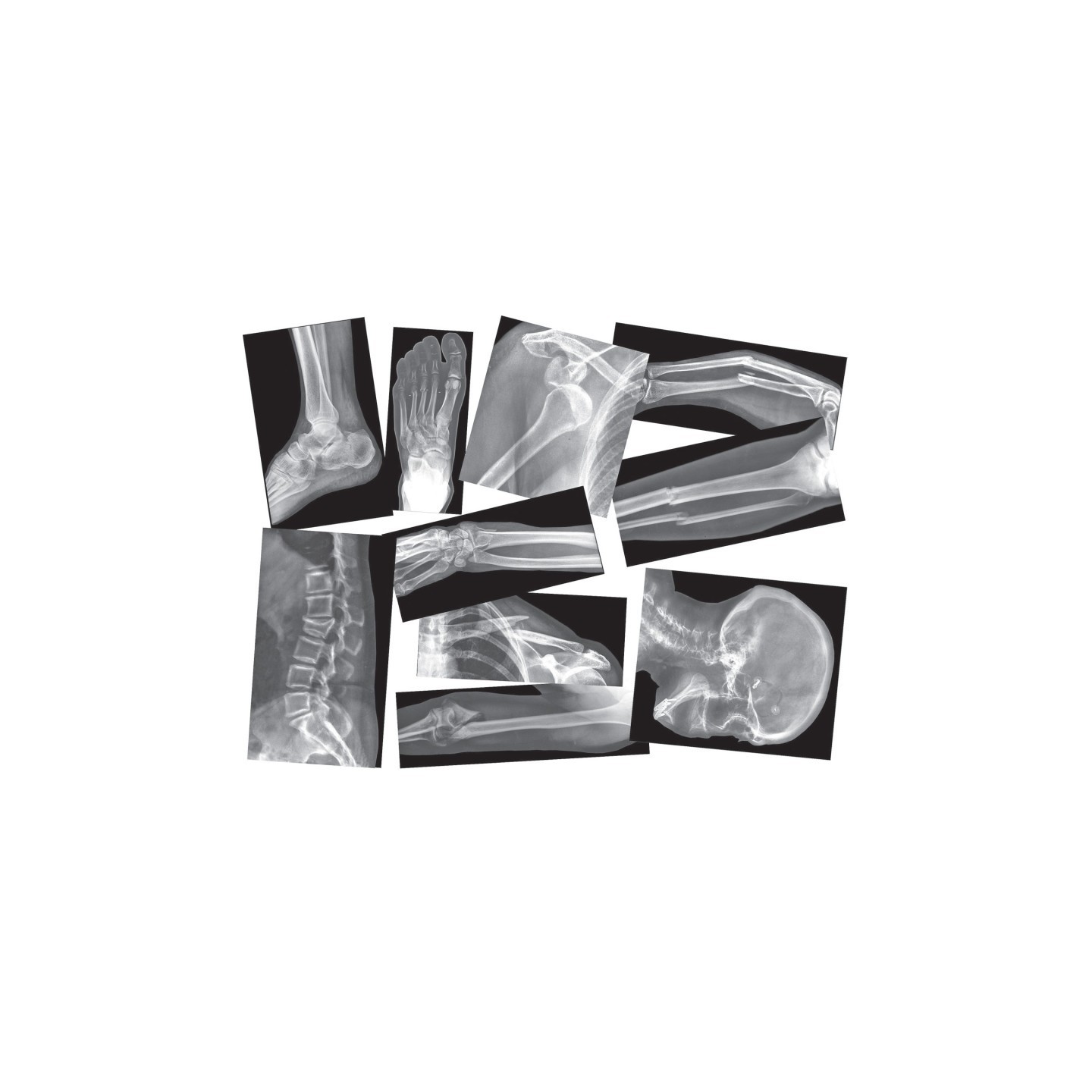 Roylco® Broken Bones X-Ray Set, Pack of 15
