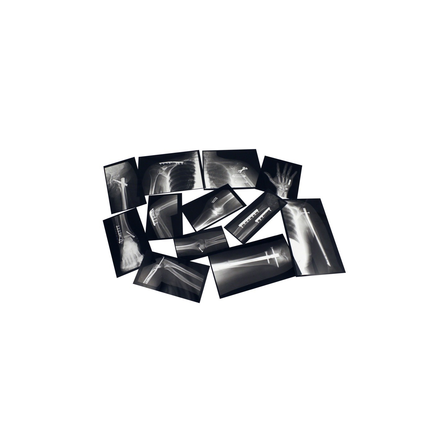 Roylco® Fixed Bones X-Ray Set
